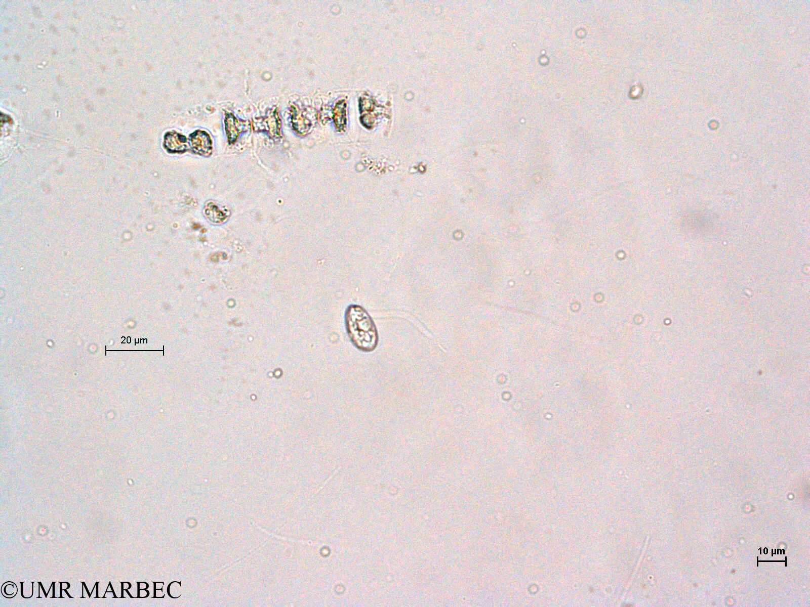 phyto/Thau_Lagoon/THAU_station1/GELAMED 2010/Chaetoceros sp5 et Nanoflagellé 2 (3)(copy).jpg